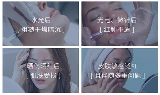 医用洁面-专为敏感肌、项目后损伤肌研发的医用皮肤护理膏