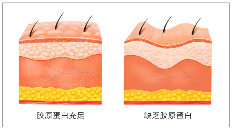 湖南微肽生物 | 涂抹式水光，医用重组Ⅲ型人源胶原蛋白液体式敷料！